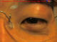 nag's eye